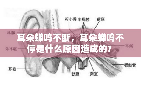 耳朵蟬鳴不斷，耳朵蟬鳴不停是什么原因造成的? 