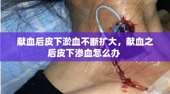 獻血后皮下淤血不斷擴大，獻血之后皮下滲血怎么辦 