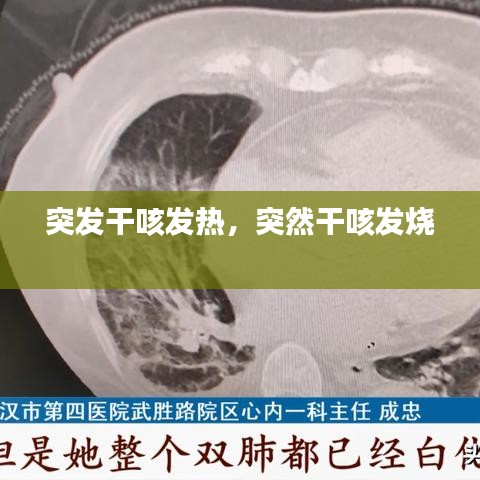 突發(fā)干咳發(fā)熱，突然干咳發(fā)燒 