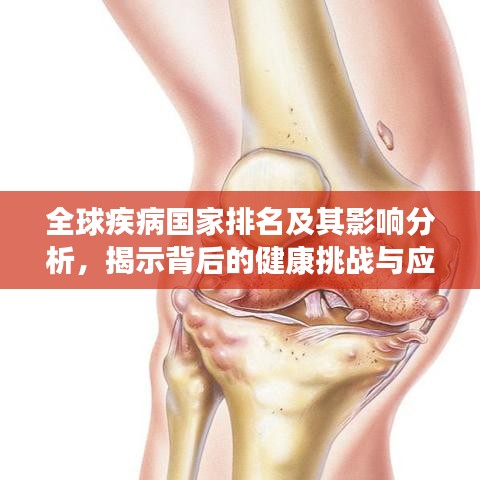 全球疾病國家排名及其影響分析，揭示背后的健康挑戰(zhàn)與應(yīng)對策略