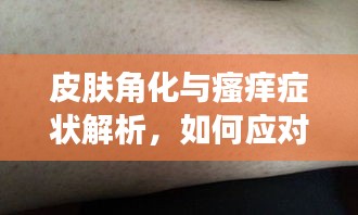 皮膚角化與瘙癢癥狀解析，如何應(yīng)對角化帶來的困擾？