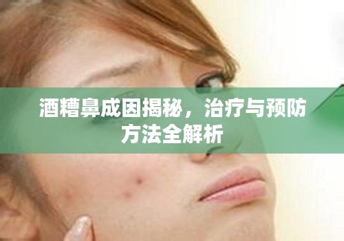 酒糟鼻成因揭秘，治療與預(yù)防方法全解析