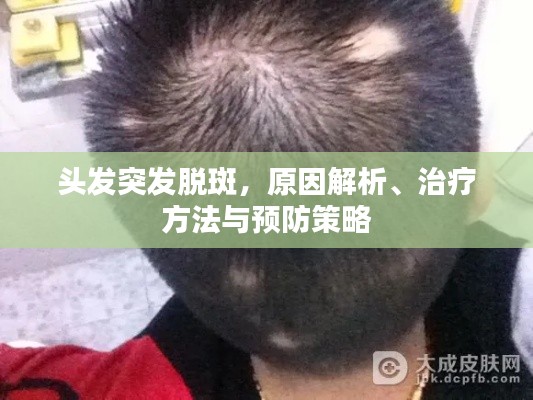 頭發(fā)突發(fā)脫斑，原因解析、治療方法與預防策略