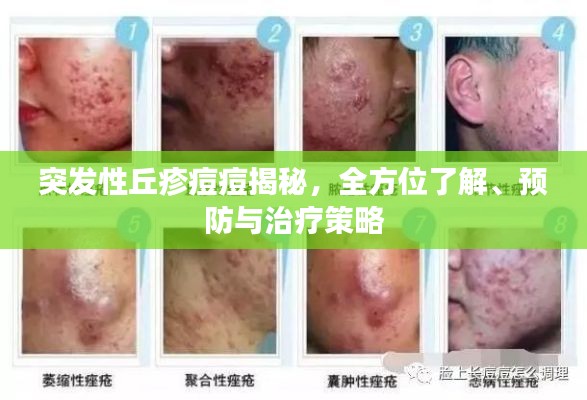 突發(fā)性丘疹痘痘揭秘，全方位了解、預(yù)防與治療策略