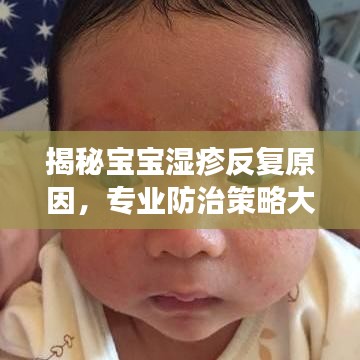 揭秘寶寶濕疹反復原因，專業(yè)防治策略大解析！