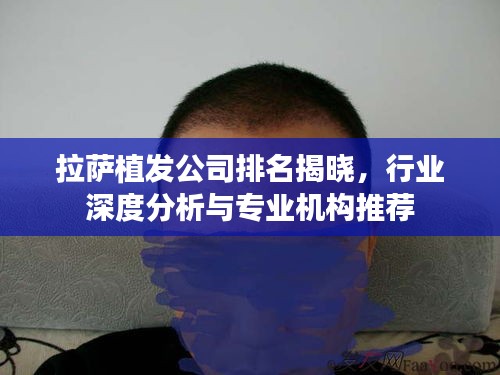 拉薩植發(fā)公司排名揭曉，行業(yè)深度分析與專業(yè)機構(gòu)推薦